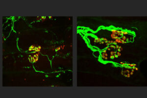 New strategy shows potential to block nerve loss in neurodegenerative diseases